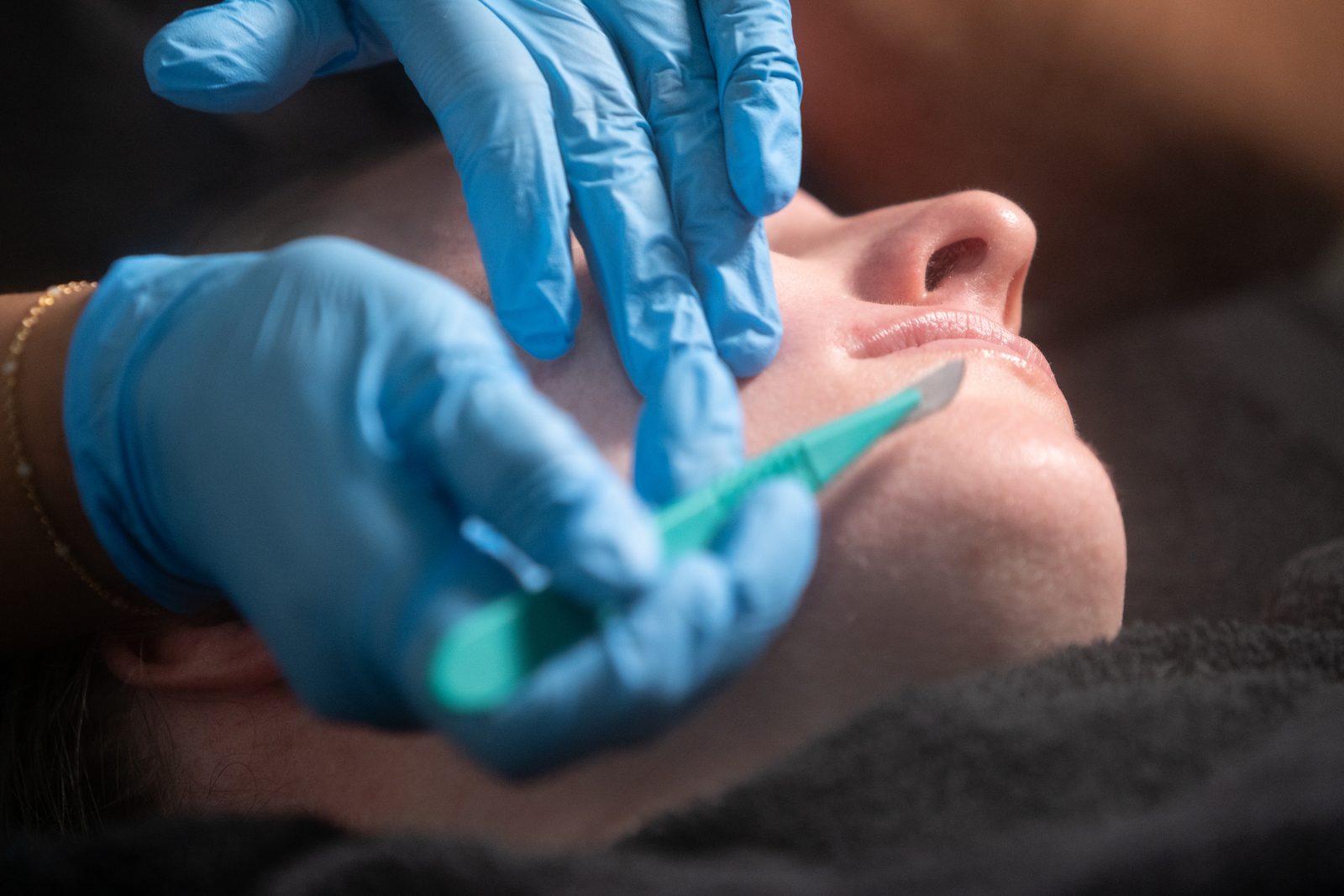 Close-up of a gloved person performing dermaplaning on a patient's cheek